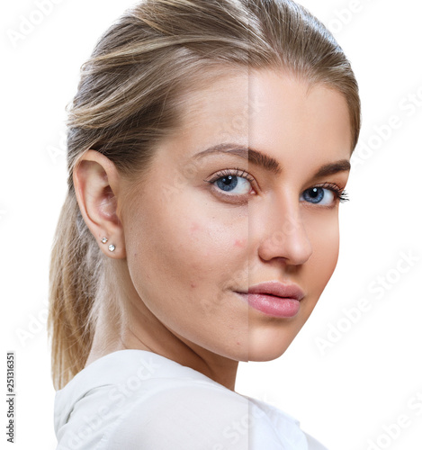 Foto Young woman before and after skin treatment and makeup.