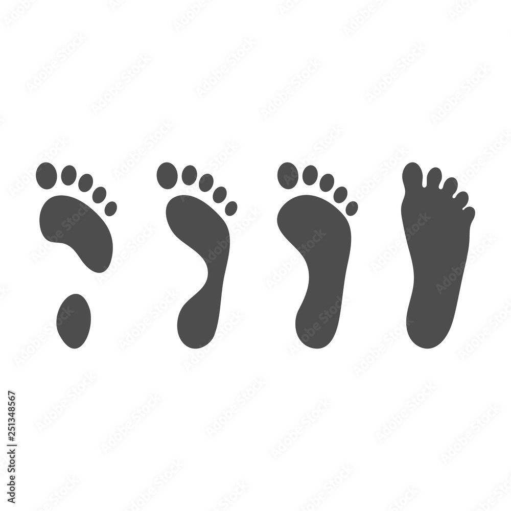 Foot Pathologies, Normal, Flat And Hollow Foot Isolated On A White Background. Vector Illustration. Orthopedics, Organs Concept. Foot Pathologies, Normal, Flat And Hollow Foot Isolated On A White Background. Vector Illustration. Orthopedics, Organs Concept.