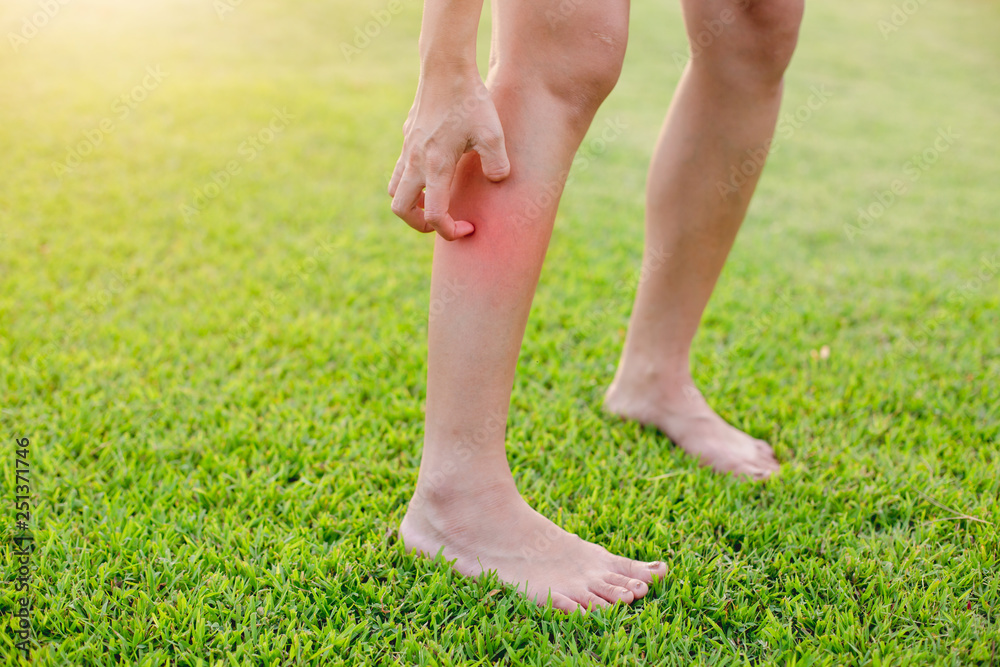 Women with his feet, itching on the lawn caused by insect bites and