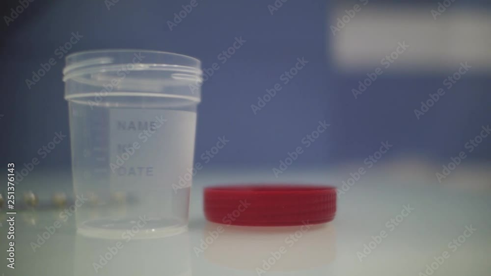 empty urine container with the lid open on the doctor's desk.container for urine analysis empty urine container with the lid open on the doctor's desk.container for urine analysis