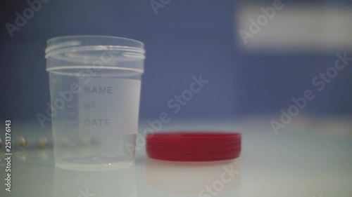 empty urine container with the lid open on the doctor's desk.container for urine analysis