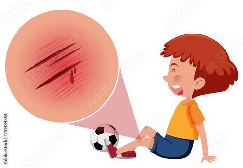 A boy injured from playing football