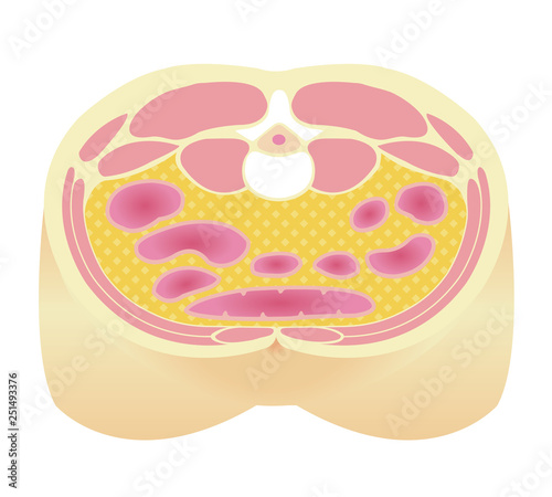 Type of obesity illustration . Abdominal sectional View (visceral fat ). 