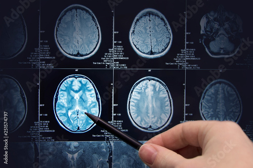 Brain research, magnetic resonance imaging