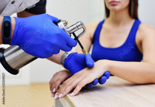 the doctor the dermatologist doing the procedure - cryotherapy - cold treatment is a special apparatus with cryodestruction photo