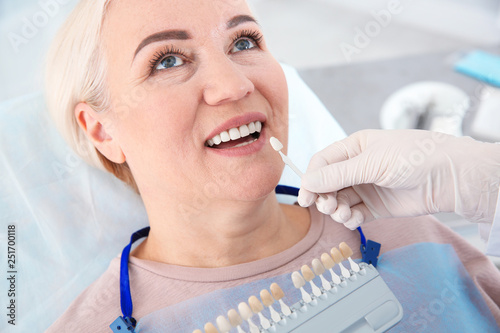 Dentist selecting patient's teeth color with palette in clinic