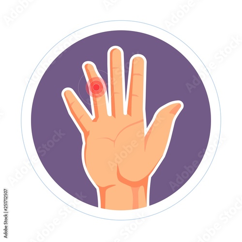 Finger injury isolated human palm rheumatoid arthritis or dislocation
