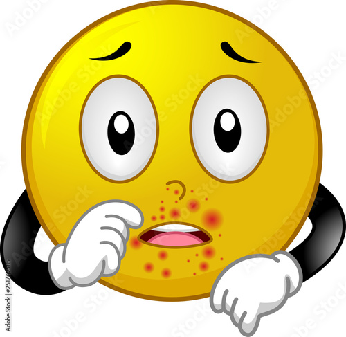 Smiley Mascot Impetigo Illu...