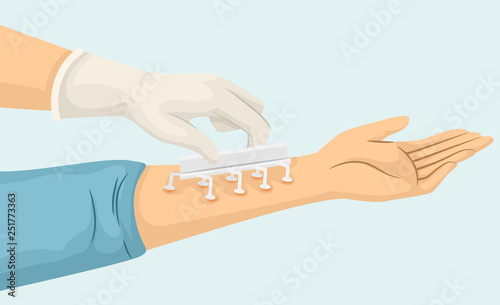 Hands Arm Allergy Skin Test Illustration
