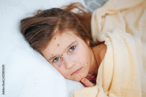 Obraz na plátně Closeup of cute sad little girl in bed