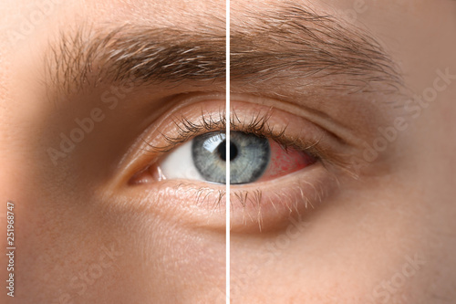 Young man with blue eyes, closeup photo