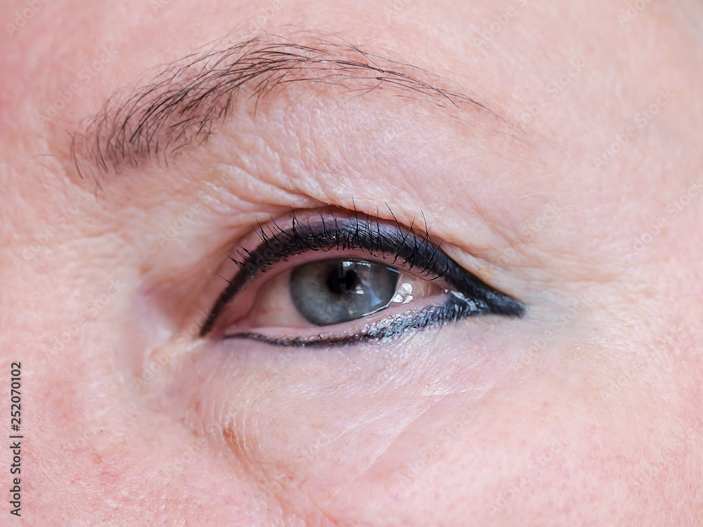 Female eye. Swelling of the mucous membrane. Examination by an