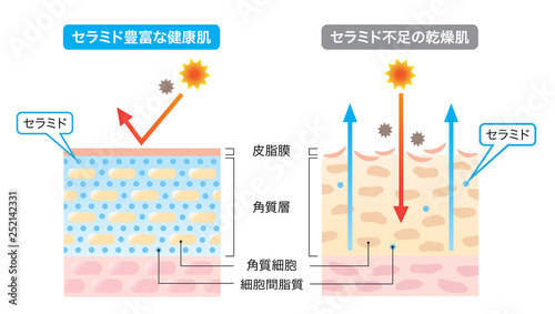 セラミド　健康な肌　乾燥肌