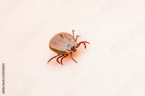 Encephalitis Virus or Lyme Borreliosis Disease Infectious Dermacentor Tick Arachnid Parasite Insect on Skin Macro © nechaevkon
