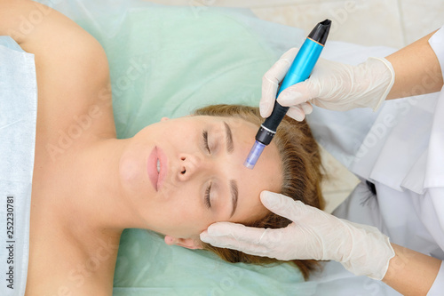 Cosmetologist making mesotherapy injection. Microneedle mesotherapy. Treatment woman at beautician. Hardware cosmetology. Mesotherapy, dermapen, treatment of face zone, face rejuvenation.  Close up