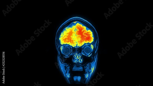 Computed medical tomography MRI upscaled scan of healthy young female head. Front view. Discrete slices. Red, yellow, blue on black background.
