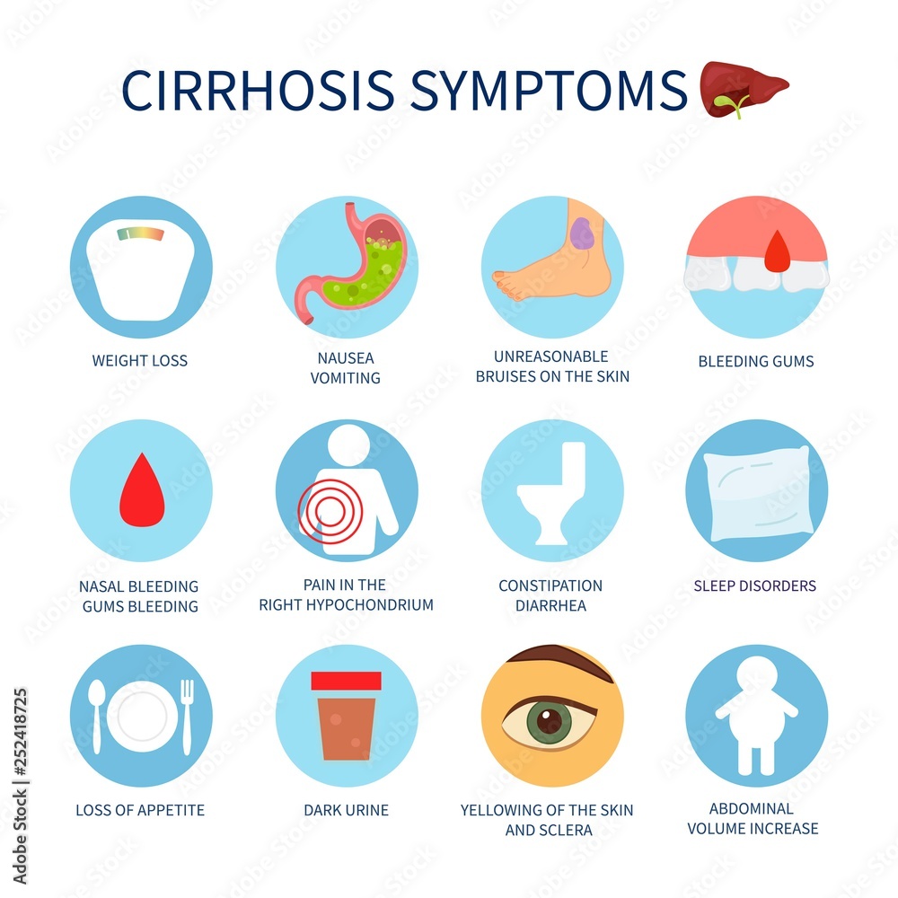 Vector poster of liver cirrhosis symptoms. Set of vector icons with symptoms of illness.