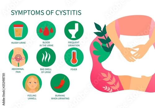 Vector medical poster symptoms of cystitis. Diseases of the genitourinary system. Illustration of a girl in a skirt.