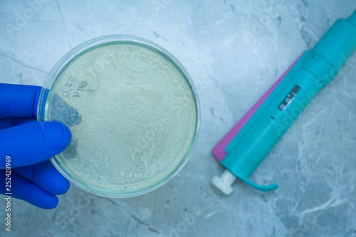 Bacteria in the hands of man. The scientist looks at the bacteria on the Petri dish. photo