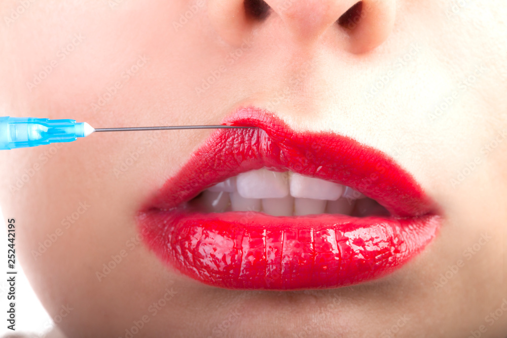Obraz premium Beautiful young woman receiving filler injection in lips, closeup