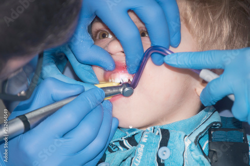 Process treatment of teeth a young boy in dental clinic