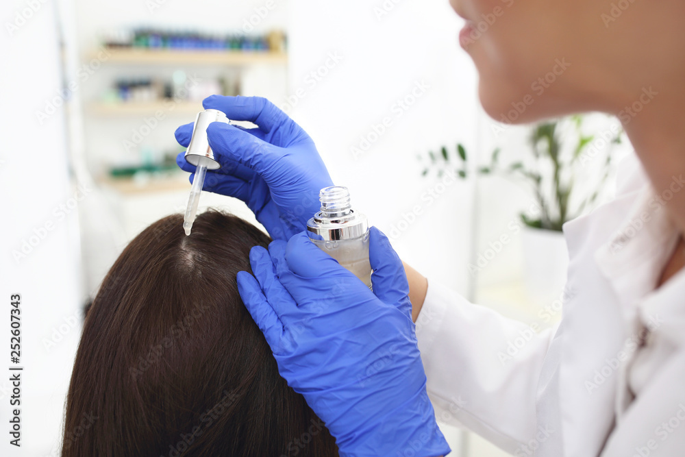 Fototapeta premium Łupież. Dermatolog nakłada lekarstwo na skórę głowy kobiety.