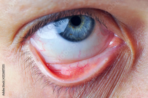 Eye and conjunctival sac. photo
