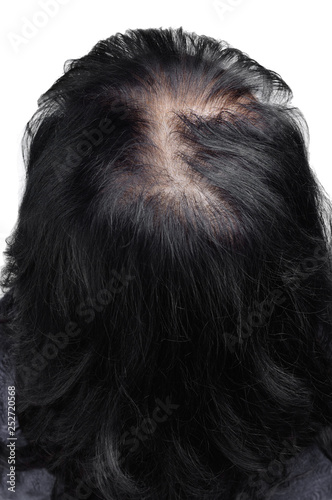 Women hair after using cosmetic powder to thicken hair. Photo before.