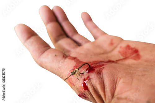 The wound was caught fishing at hand isolated on white background of file with Clipping Path .