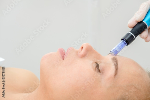 Cosmetologist making mesotherapy injection. Microneedle mesotherapy. Treatment woman at beautician. Hardware cosmetology. Mesotherapy, dermapen, treatment of face zone, face rejuvenation. Close up