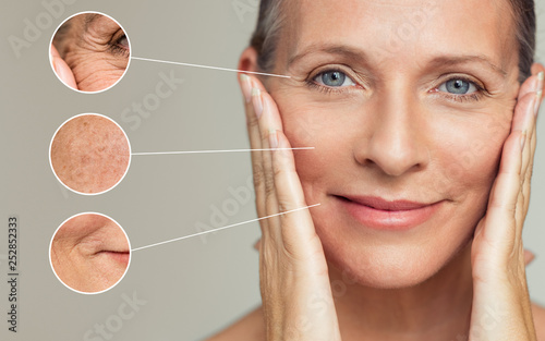 Fotografia, Obraz Wrinkles and skin imperfection