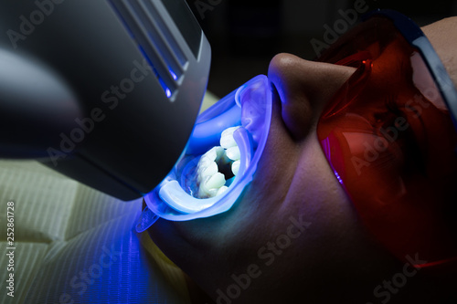 Female receiving teeth whitening procedure. Portrait of a female patient at dentist in the clinic. Teeth whitening procedure with ultraviolet light UV lamp. LED lamp for Teeth whitening procedure photo
