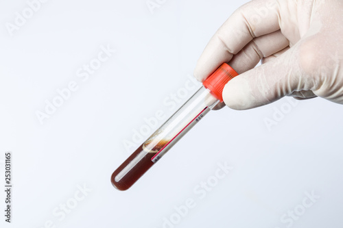 Doctor's hand with medical glove holds a blood probe