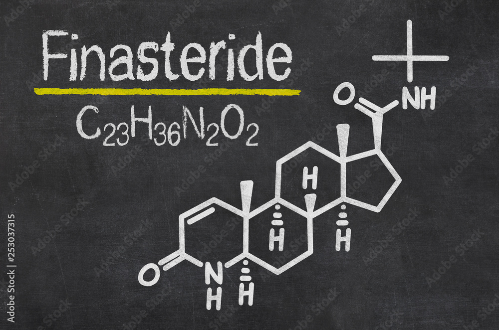 Blackboard with the chemical formula of Finasteride Blackboard with the chemical formula of Finasteride