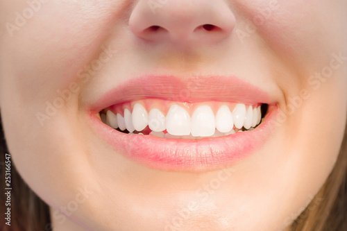 Adult young woman is ready for dentist's check up in dental office. Smiling mouth with white teeth after hygienist visit. Closeup. Front view.