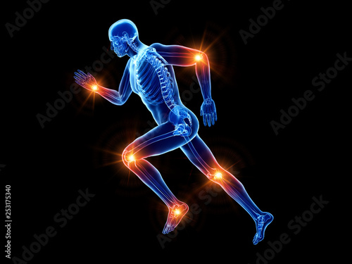 3d rendered illustration of a joggers painful joints © Sebastian Kaulitzki