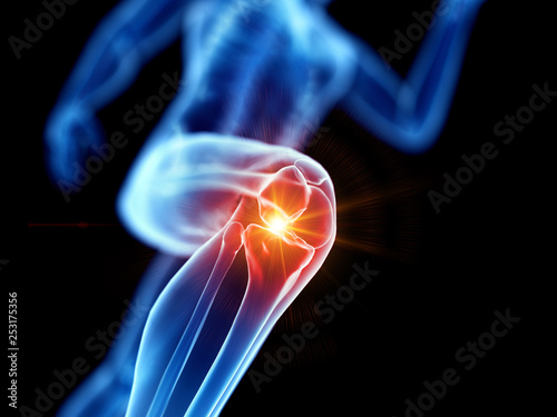 3d rendered illustration of a joggers painful knee photo