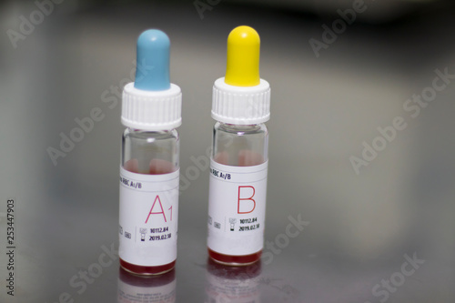 reagents to determine blood group. standard red blood cells. RBC. gel technology. Concept: medicine, tests.