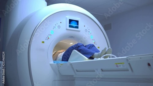 scan of the human brain using a computer tomograph