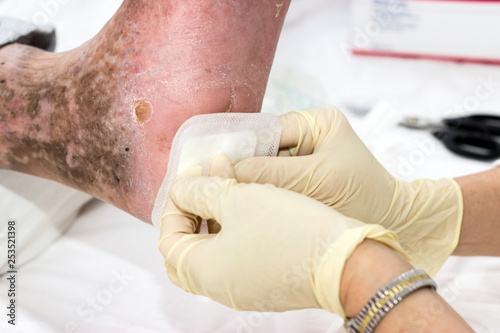diabetes care
