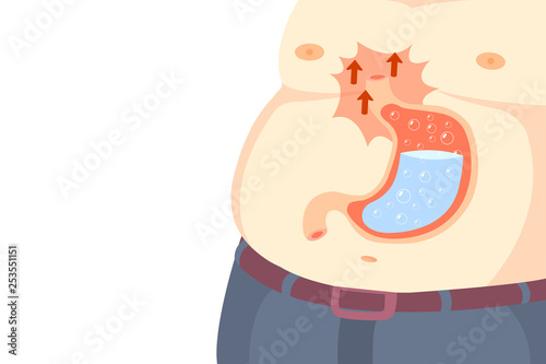 Gastritis is caused by several causes. Gastritis is common with all ages.