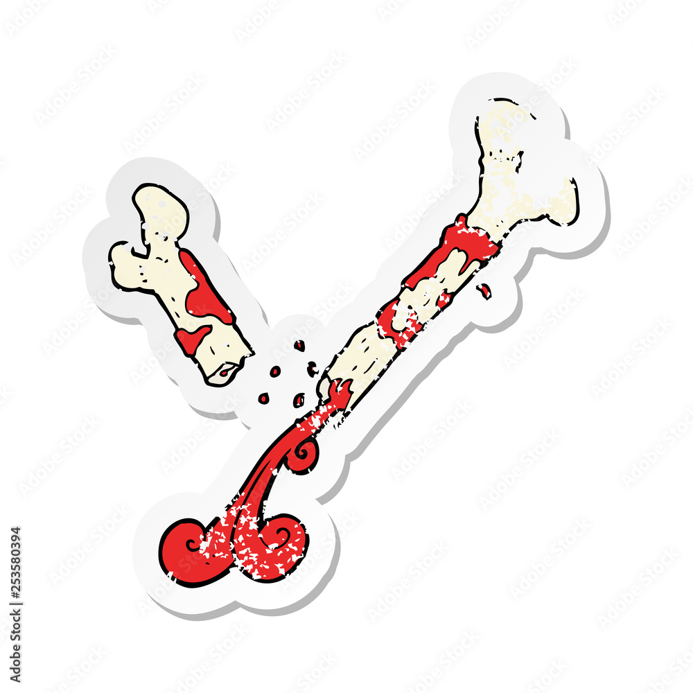 retro distressed sticker of a gross broken bone cartoon