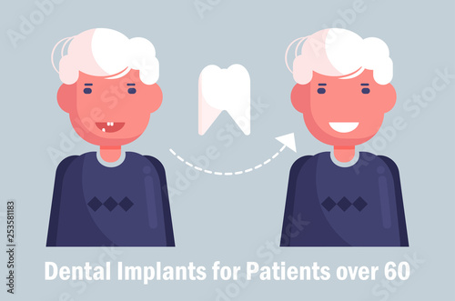 Dental implants for the elderly Vector. Cartoon. Isolated art Man