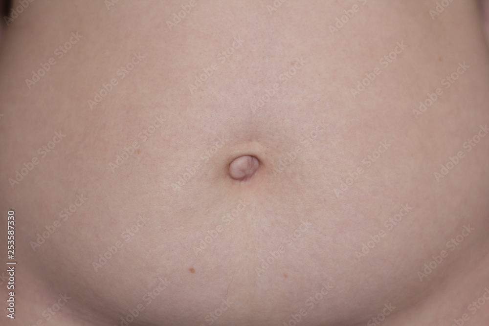 belly with a scar and stretch marks. postpartum woman's belly. ugly body. belly with a scar and stretch marks. postpartum woman's belly. ugly body.