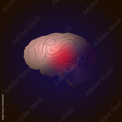 Transition from real to x-ray effect from points. Brain Diseases with a pain point. medical illustration