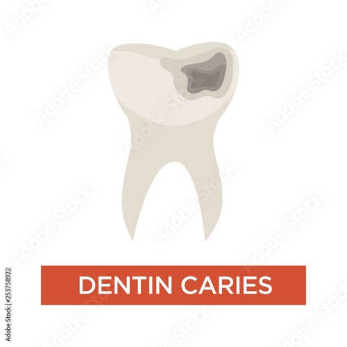 Dentin caries dental care tooth damage hole dentistry