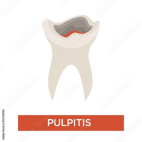 Tooth decay caries stage dentistry and dental health pulpitis