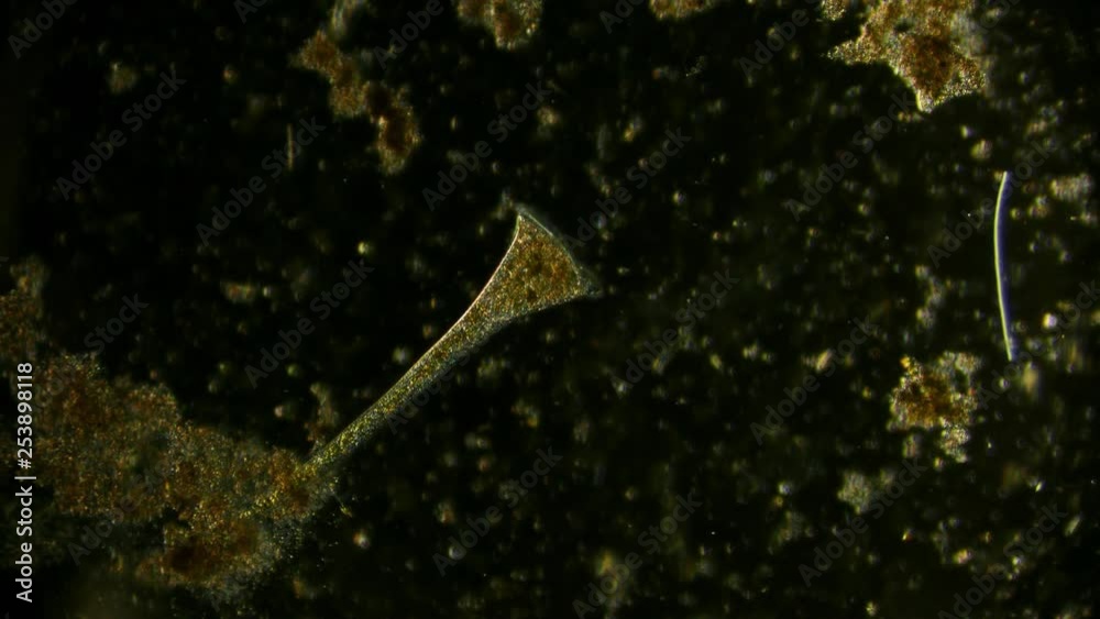 stentor protozoa offaxis illumination of in pond