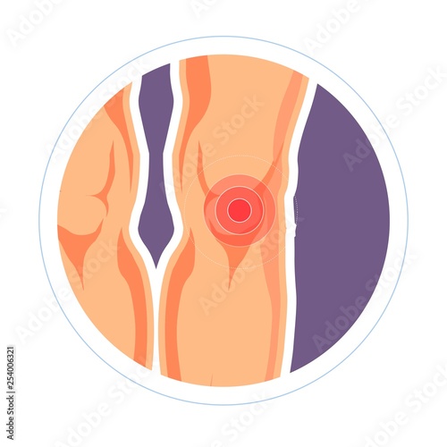 Injury knee joint pain and swelling legs medicine and rheumatology
