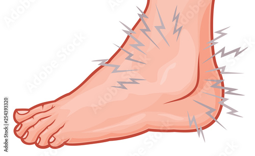 Ankle sprain vector illustration